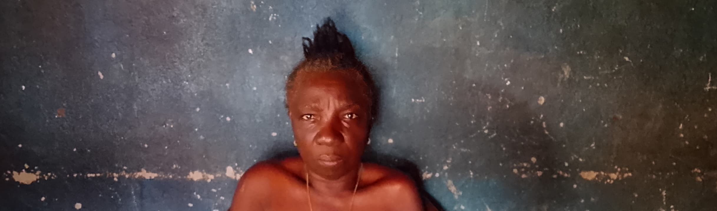 Adama Sankoh, who is both a diabetic and a hypertension patient, is sitting on her veranda at her home in Mile 91.